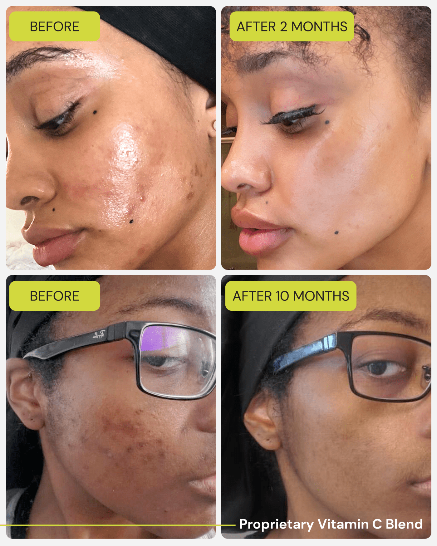 Vitamin C Treatment Mask w/ Brush Wash Off Masks Gleamin 